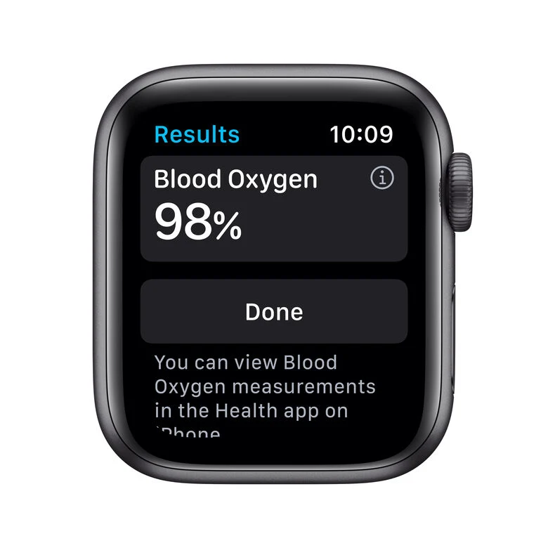 Apple Watch Serie 6 GPS + Cellular, 40mm in alluminio grigio siderale con cinturino Sport Nero